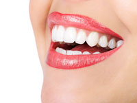 Invisalign