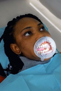 wisdom teeth extraction