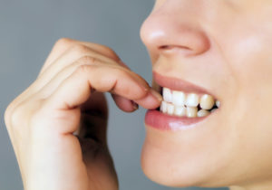 Dental Fear Smile Designs of Olney